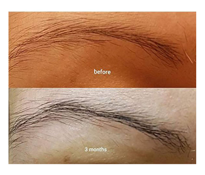 The Ordinary 60ml Multi-Peptide Serum For Hair Density 4 in UAE