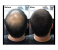 Nitro Canada Cinema Professional Hair Building Fibers 22GM 3 in UAE