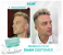 SAAM Renewal Face Cream – All-in-One Solution for Melasma & Freckles 7 in UAE