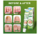 New Sumifun Nail Fungal Feet Cream Foot Toe Nail Fungus Gel 3 in UAE