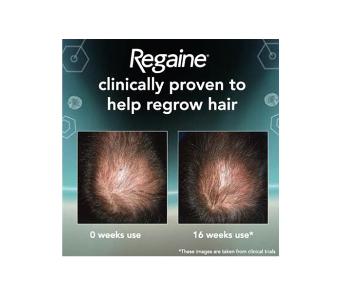 Regaine For Men Hair Regrowth Foam 3 x 73ml  - Zoom Image 2