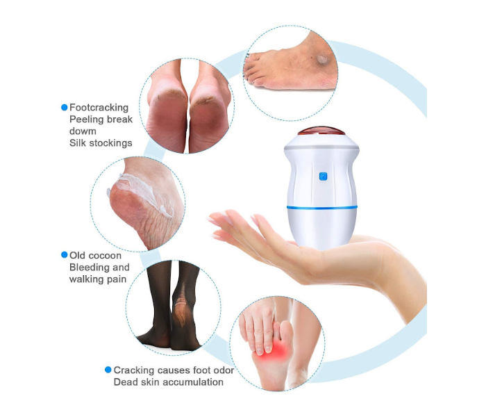 GTC 22000624 Callus Remover for Feet - White - Zoom Image 2