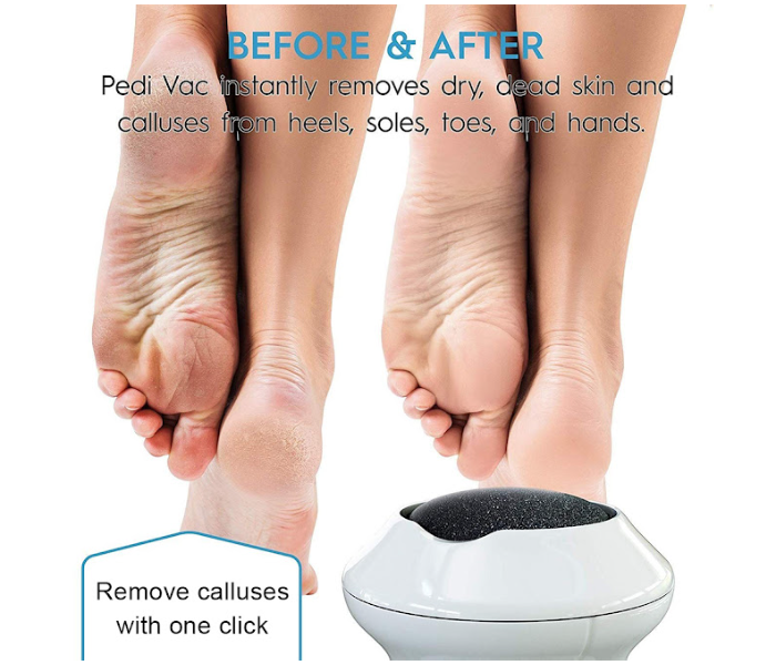 GTC 22000624 Callus Remover for Feet - White - Zoom Image 4