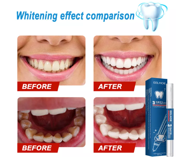 Eelhoe 3ml Stains Remover Teeth Whitening Pen - White - Zoom Image 5