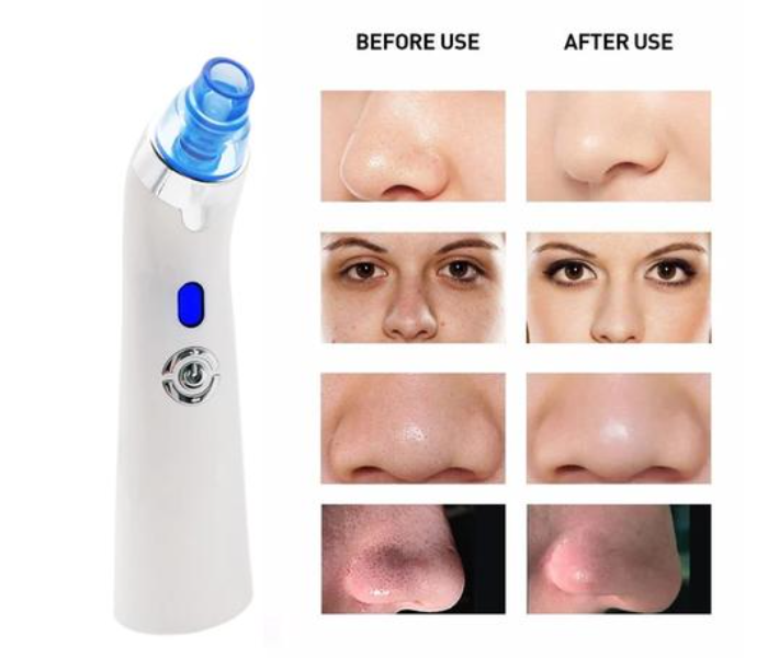 Rechargeable BR-8 Vacuum Suction Blackhead Remover - White - Zoom Image 4