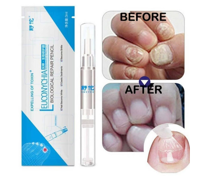 GTC 22000704 Leuconychia Biological Repair Pencil For Toe and Finger Nail Treatment - White - Zoom Image 4