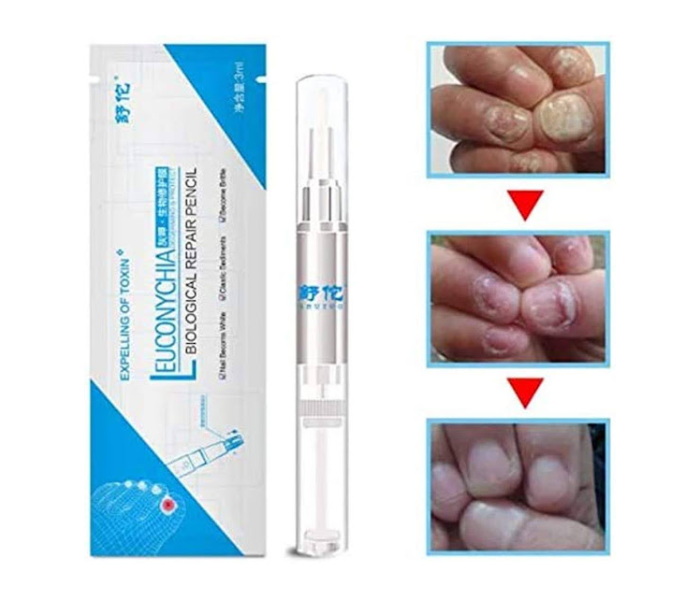 GTC 22000704 Leuconychia Biological Repair Pencil For Toe and Finger Nail Treatment - White - Zoom Image 3