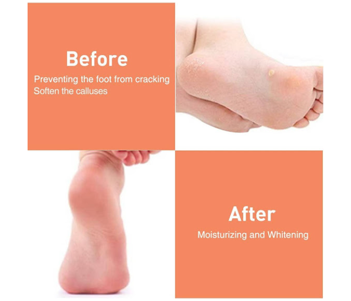 GTC 22000722 One Pair Silicone Gel Heel Protectors for Women and Men - Skin - Zoom Image 5