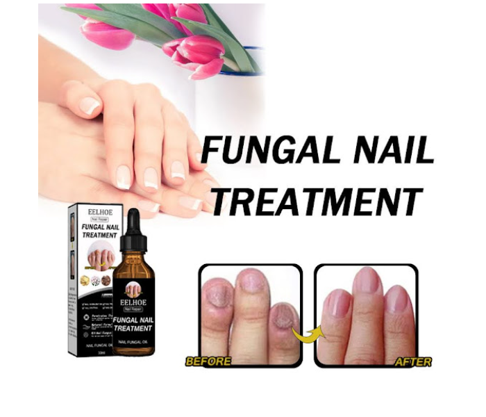 GTC 22000699 Nail Fungus Repair Liquid for Toe and Finger Nails - Zoom Image 4