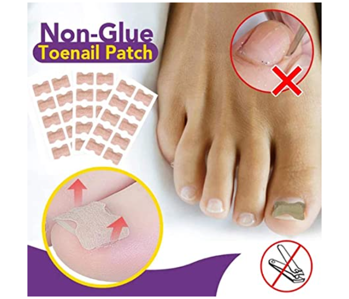 Set of 3 (30 pieces) Glue Free Toenail Patch Care Tool Professional Pedicure for Men and Women - Zoom Image 4