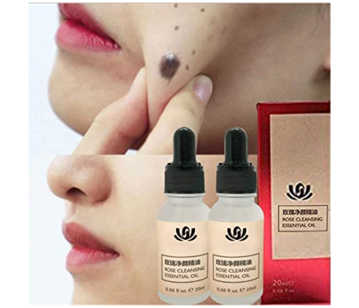 Organic Tags Solutions Instant Skin Tag Mole Remover Serum - Zoom Image 1