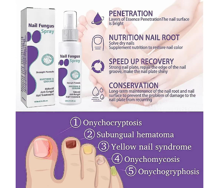 Jaysuing 100ml Advanced Foot And Nail Fungus Spray for Natural Anti-Fungal Nail and Toenail Treatment - Zoom Image 3