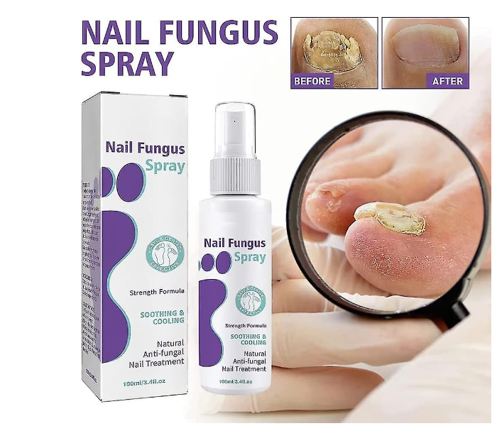 Jaysuing 100ml Advanced Foot And Nail Fungus Spray for Natural Anti-Fungal Nail and Toenail Treatment - Zoom Image 2