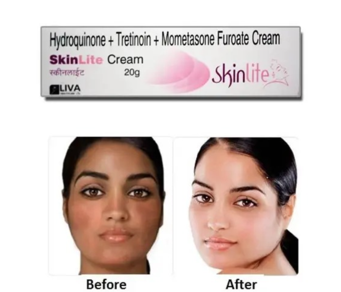 Skin Light Whitening Cream 25grm - Zoom Image 3