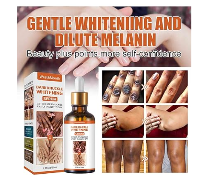 GFOUK Acanthosis Nigricans Brightening Serum, Dark Knuckle/Joint Whitening Serum, Correction Oil for Body Dark Spots, Brightening Moisturising Skin Rejuvenation Skin Tones, 50 ml  - Zoom Image 1