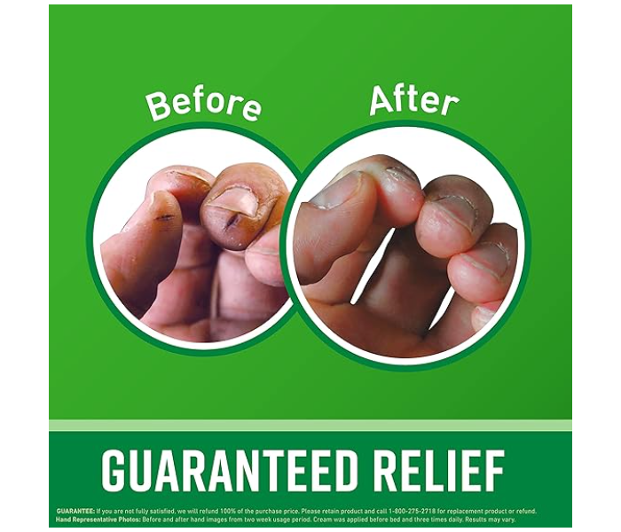 Bundle 3 PCs Set Repair Working 100Gm Hands Image