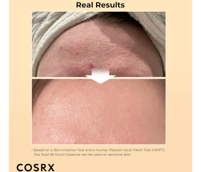 Cosrx 100ml Advanced Snail 96 Mucin Power Essence - Moisturizing and Nourishing Essence with Snail in UAE