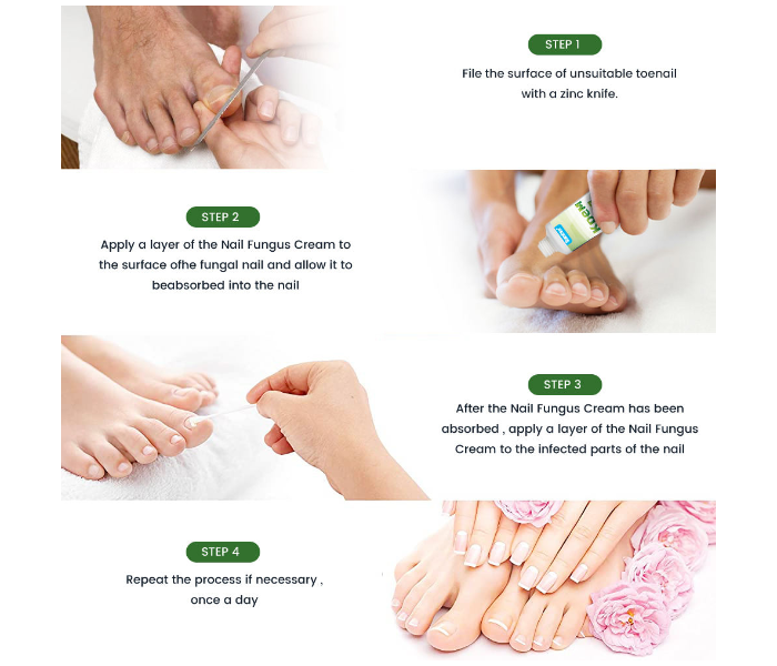 New Sumifun Nail Fungal Feet Cream Foot Toe Nail Fungus Gel in UAE
