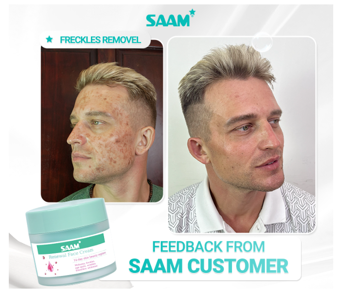 SAAM Renewal Face Cream – All-in-One Solution for Melasma & Freckles in UAE
