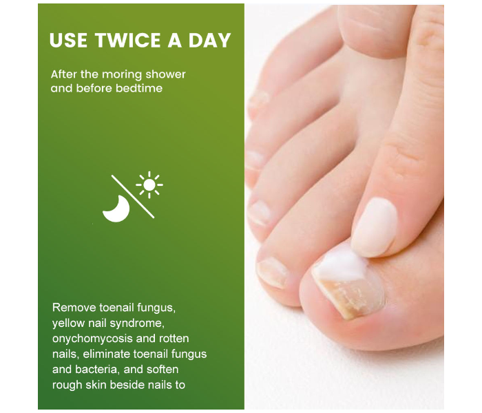 New Sumifun Nail Fungal Feet Cream Foot Toe Nail Fungus Gel in UAE