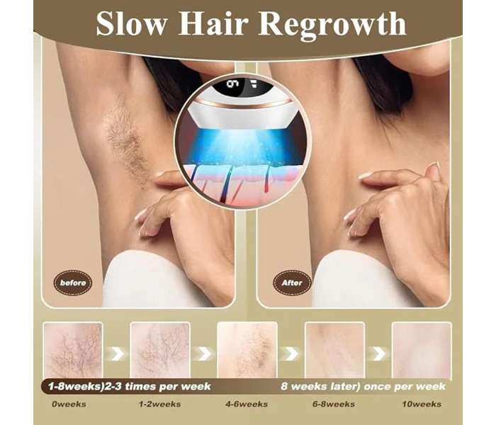 IPL Hair Removal Device Laser Hair Remover (White) in UAE