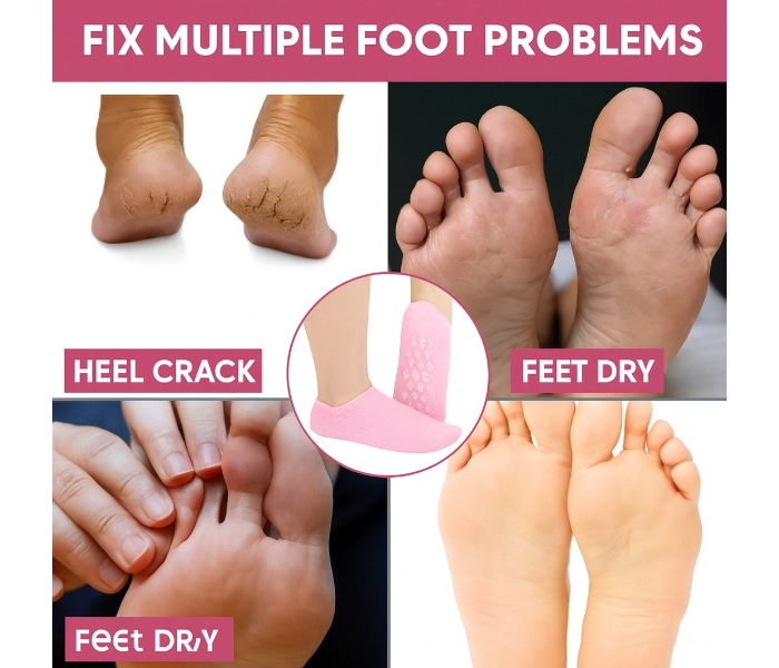 Moisturizing Gel Socks with Rose Oil, Pack of 1 (Free Size, pink) in UAE