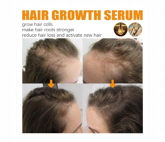 5 Pcs EELHOE BIOTIN Hair Growth Serum 30ml - Zoom Image 2