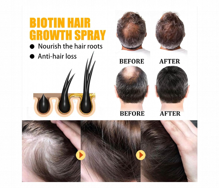 5 Pcs EELHOE BIOTIN Hair Growth Serum 30ml - Zoom Image 4