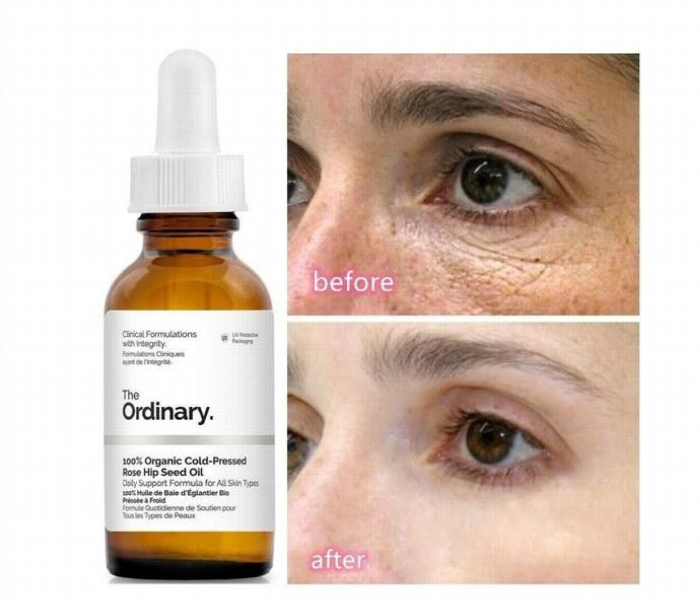 THE ORDINARY Organic Cold Pressed Moroccan Argan Oil 30ml - Zoom Image 2