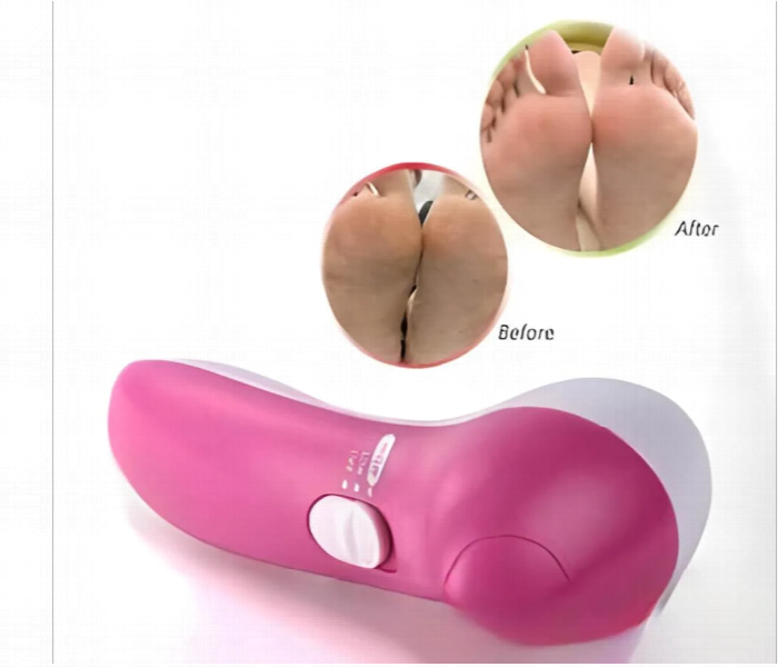 7 In 1 Callus Remover And Foot Massager Kit For Dead Skin Cracked Heels Exfoliation Pedicure And Foot Care - Zoom Image 2