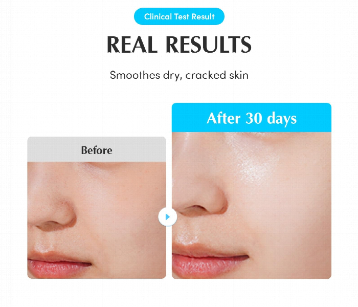 Eqqualberry Swimming Pool Ampoule - Zoom Image 3